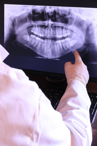 Best Emergency Dental Extractions in Morton, WA