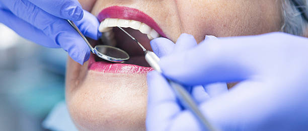 Best Mobile Emergency Dentist in Morton, WA