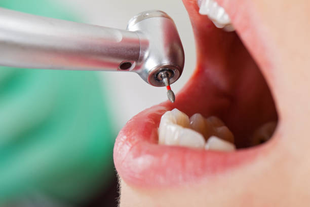 Best Mobile Emergency Dentist in Morton, WA
